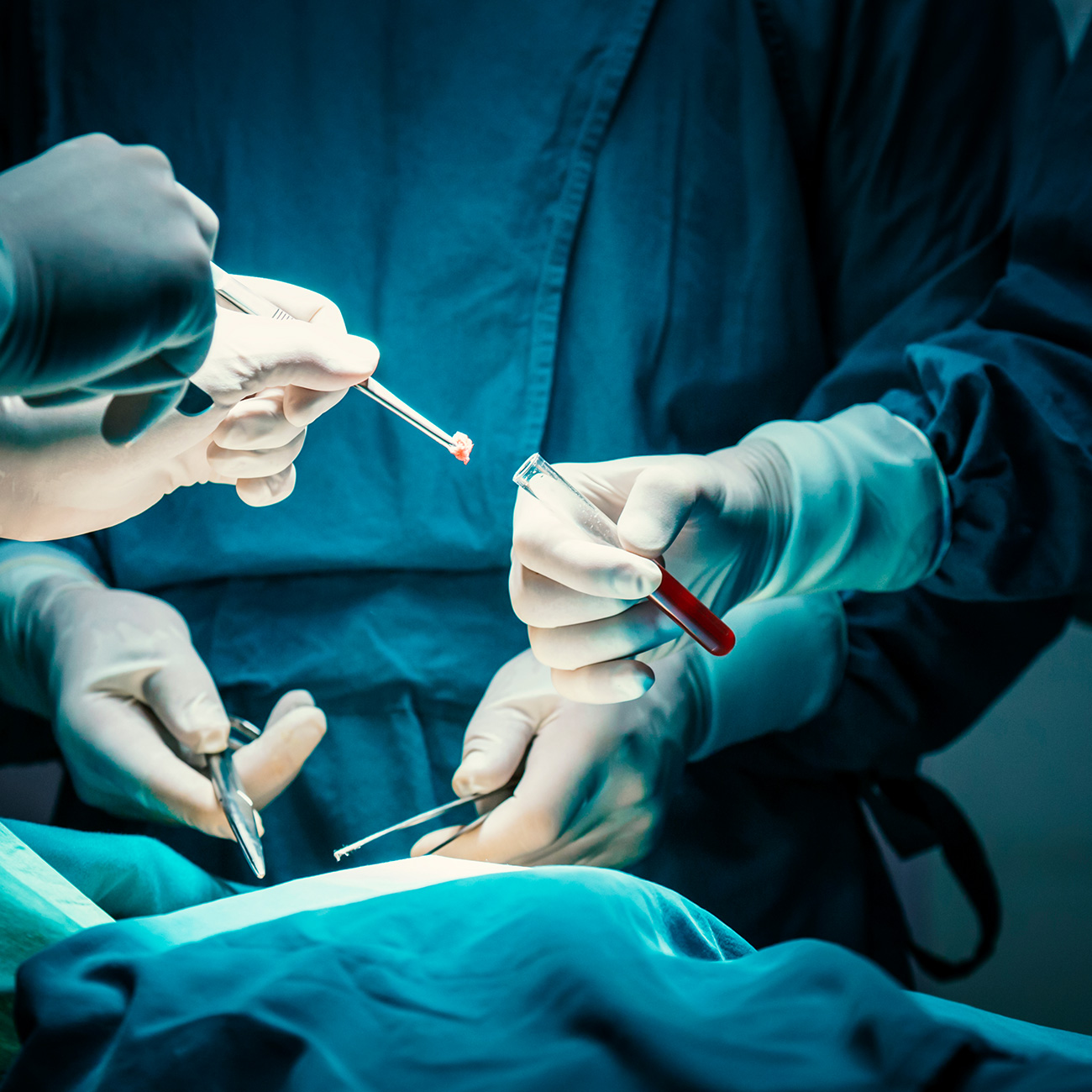 Bi&oacute;psia transretal